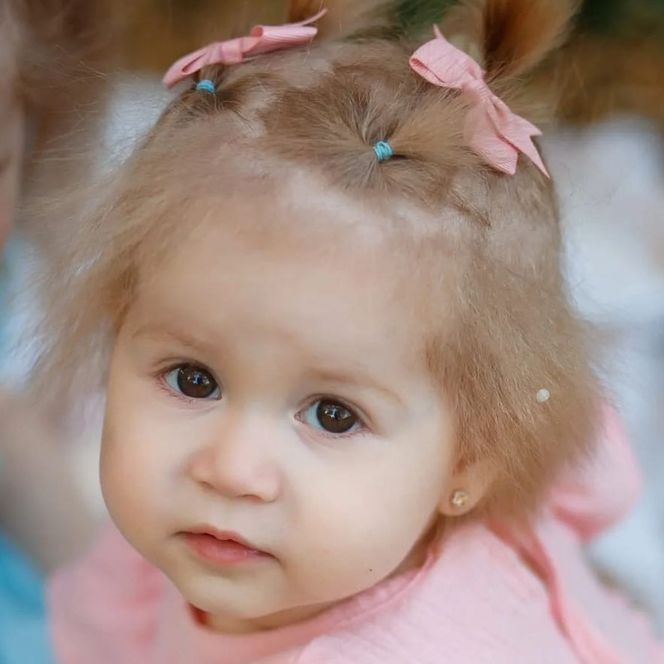 Анфиса Астафорова, Острый миелобластный лейкоз — Ребенок умер ...