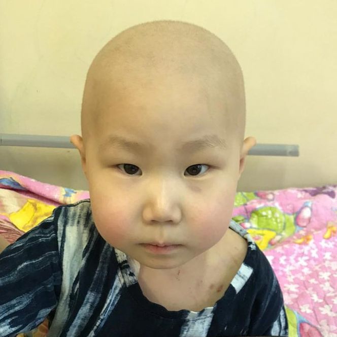 Витя Тарнуев, острый миелобластный лейкоз — сбор средств на лечение ...