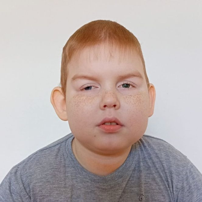 Гриша Белоусов, первичный иммунодефицит — сбор средств на лечение ...